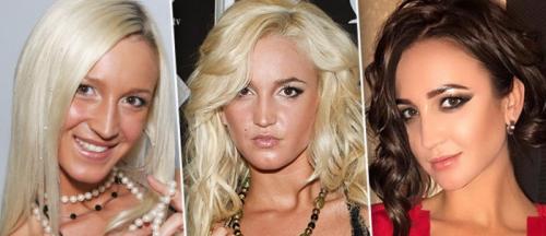 Неудачная пластика звезд россии. Топ 10 советских и российских звезд до после пластики