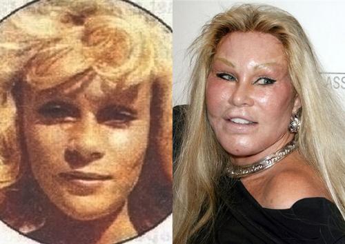 Деми Мур и другие звезды, чью жизнь изменила пластическая хирургия