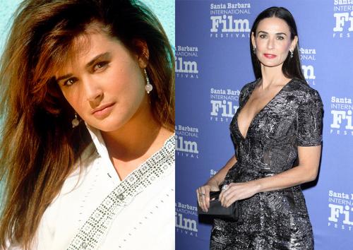 Деми Мур и другие звезды, чью жизнь изменила пластическая хирургия