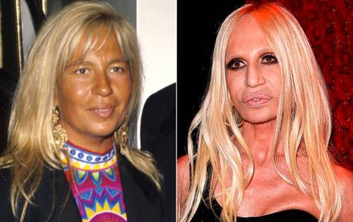 Деми Мур и другие звезды, чью жизнь изменила пластическая хирургия 12 Деми Мур и другие звезды, чью жизнь изменила пластическая хирургия 12