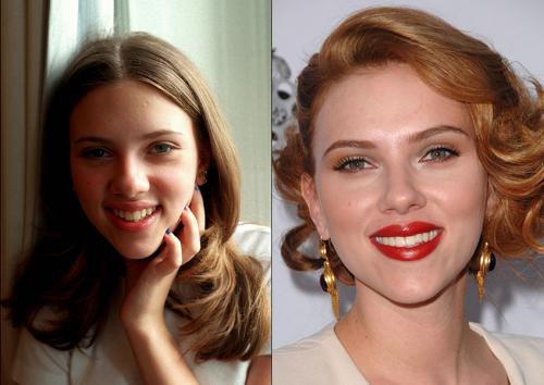 Деми Мур и другие звезды, чью жизнь изменила пластическая хирургия