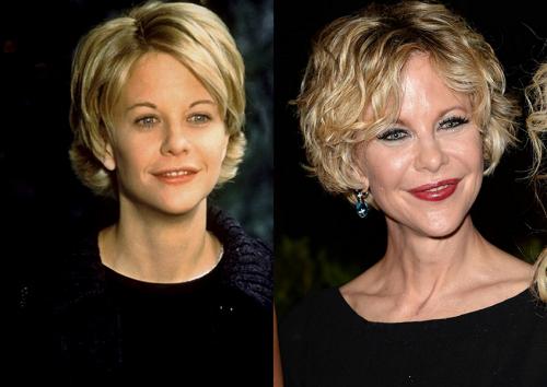 Деми Мур и другие звезды, чью жизнь изменила пластическая хирургия