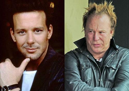 Деми Мур и другие звезды, чью жизнь изменила пластическая хирургия