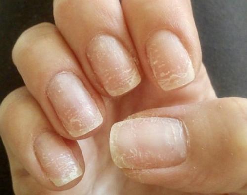 Жидкость для снятия гель-лака, как пользоваться. 9 способов —, как снять старый гель-лак не выходя из дома