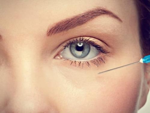 Как убрать носослезную борозду. Способы избавления от носослезной борозды 02