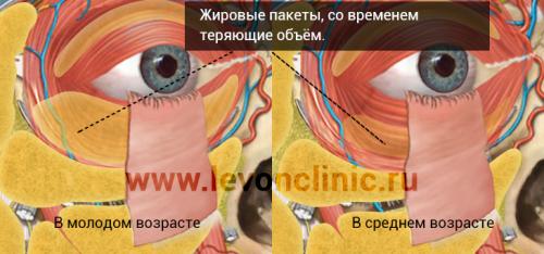 Как убрать синие круги под глазами. Болезни внутренних органов 07