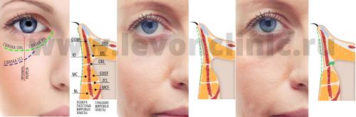 Как убрать синие круги под глазами. Болезни внутренних органов 11