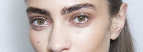 Убираем темные круги под глазами. Как убрать круги филлерами. 02