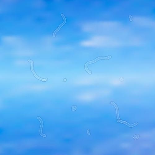 Мушки перед глазами неврология. Мушки перед глазами