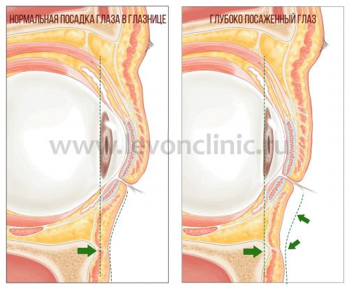 Темные уголки глаз, как избавиться. Давайте взглянем на анатомическое строение области глаз.