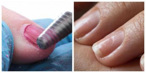 12 проблем с ногтями. Болезни ногтей 03 12 проблем с ногтями. Болезни ногтей 03