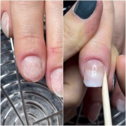 Что делать если ногтевая пластина неровная. Блог