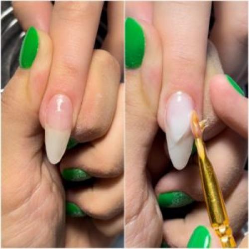 Что делать, если ногтевая пластина неровная