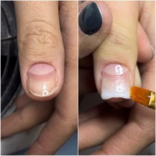 Что делать, если ногтевая пластина неровная