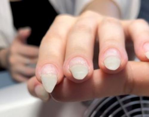 Что делать если ногтевая пластина неровная. Блог