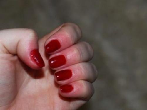 Как мастеру и клиенту избавиться от аллергии на гель-лак. Аллергия у мастера маникюра: профилактика и лечение 07