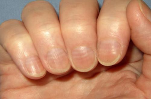 Удобно ли с нарощенными ногтями. Основной вред