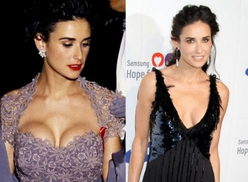 Деми Мур в молодости и сейчас. Какие пластические операции делала голливудская дива?