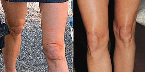 Деми Мур в молодости и сейчас. Какие пластические операции делала голливудская дива?