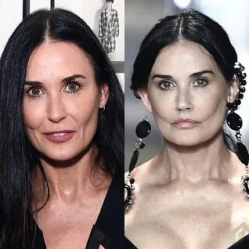 Деми Мур после пластики. Еще одна жертва пластики: Деми Мур вышла на подиум с изуродованным лицом 03