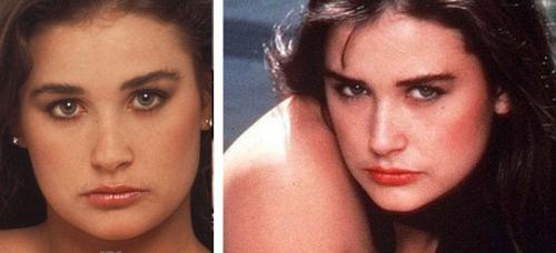 Деми Мур после пластики. Еще одна жертва пластики: Деми Мур вышла на подиум с изуродованным лицом 01