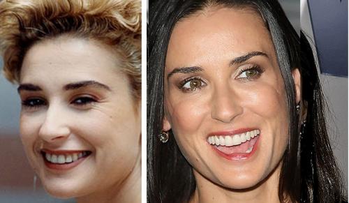 Деми Мур после пластики. Еще одна жертва пластики: Деми Мур вышла на подиум с изуродованным лицом 02