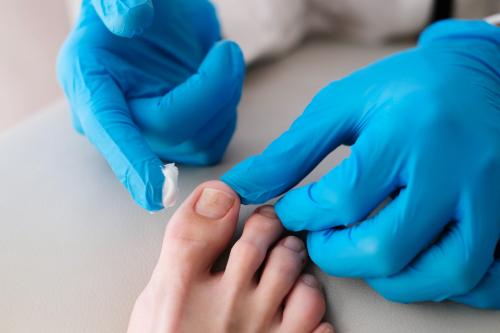 Виды деформации ногтей: что они означают и как с этим справляться 02 Виды деформации ногтей: что они означают и как с этим справляться 02