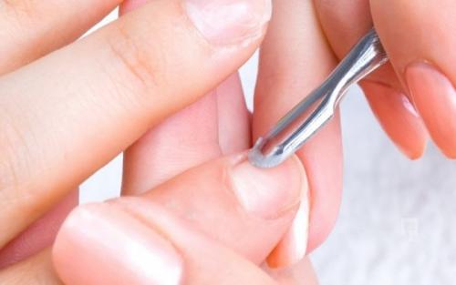 Как формируется кутикула на ногтях. Почему кутикула нарастает на ноготь