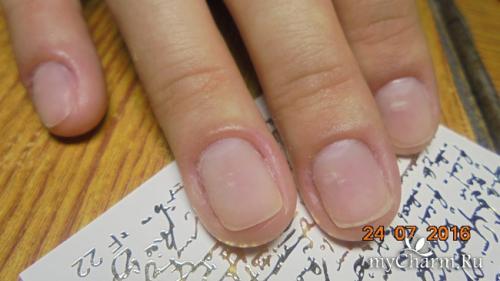 Почему ногти под гель-лаком мягкие. Всего понемногу о тонких ноготках, гель-лаке и слайдерах)))
