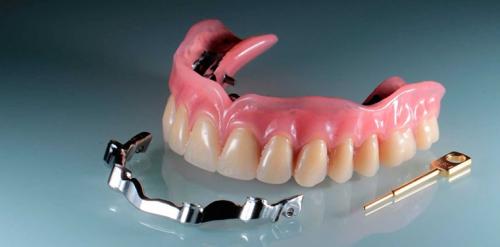 Сколько примерно времени требуется на изготовление бюгельного протеза. Особенности бюгельного протезирования