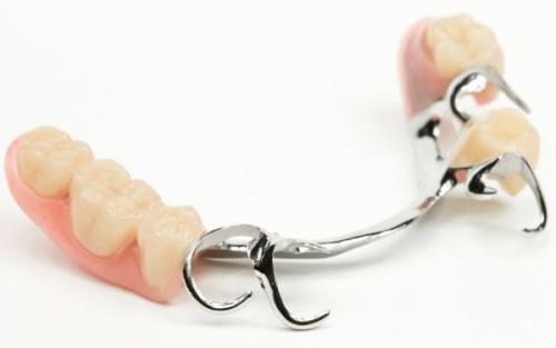 Сравнение различных типов бюгельных протезов: какой выбрать 05 Сравнение различных типов бюгельных протезов: какой выбрать 05