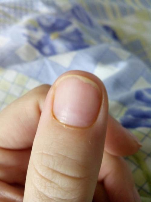 Девочки, помогите, пожалуйста, советом! 01