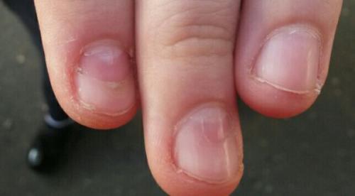 Анонимно, пожалуйста.  Девочки, подскажите, пожалуйста, чем это подлечить? 01