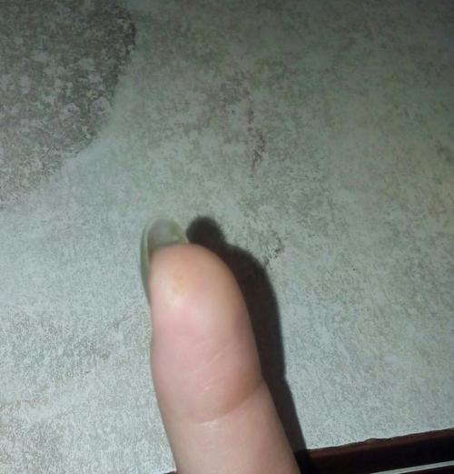 Анонимно пожалуйста!  Девочки, нужна помощь! 01