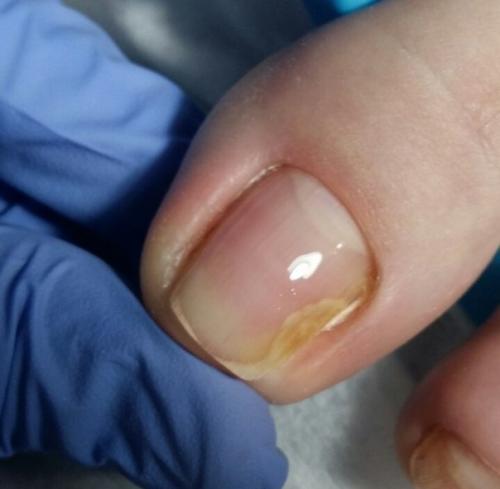 Анонимно.  Девочки, помогите! 01