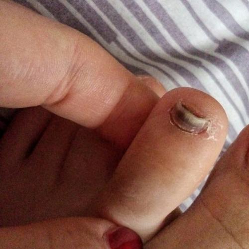 Здравствуйте!  Подскажите пожалуйста, что это может быть и как лечить? 01