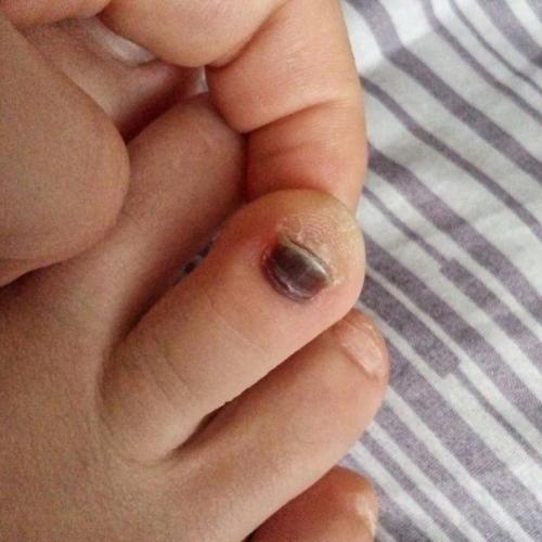 Здравствуйте!  Подскажите пожалуйста, что это может быть и как лечить? 02