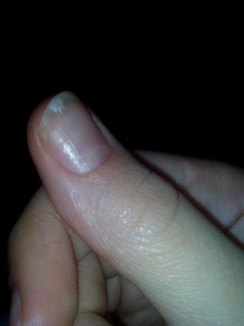 Здравствуйте!  Срочно нужен совет. 01