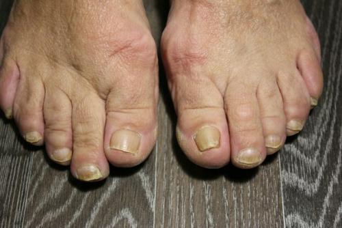 Девочки, кто делает аппаратный педикюр, сколько времени у вас уходит вот на такие ноги? 01