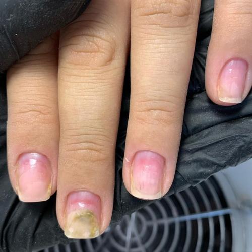 Эти ногти ко мне на коррекцию в сентябреПришли! 02 Эти ногти ко мне на коррекцию в сентябреПришли! 02