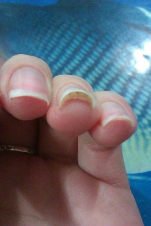 Здравствуйте, красотки!  Как вы думаете, что это может быть? 01