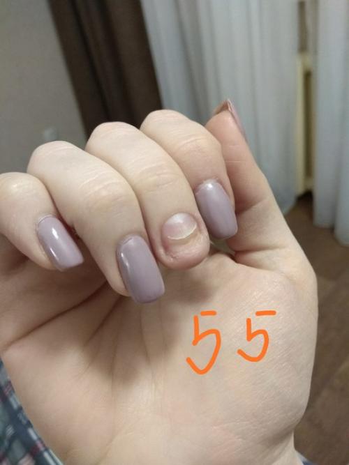 Всём привет, я выкладывали пост с просьбой о помощи 13 го января. 07 Всём привет, я выкладывали пост с просьбой о помощи 13 го января. 07