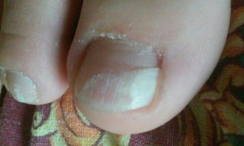 Диетические сладости для радости. 01 Диетические сладости для радости. 01