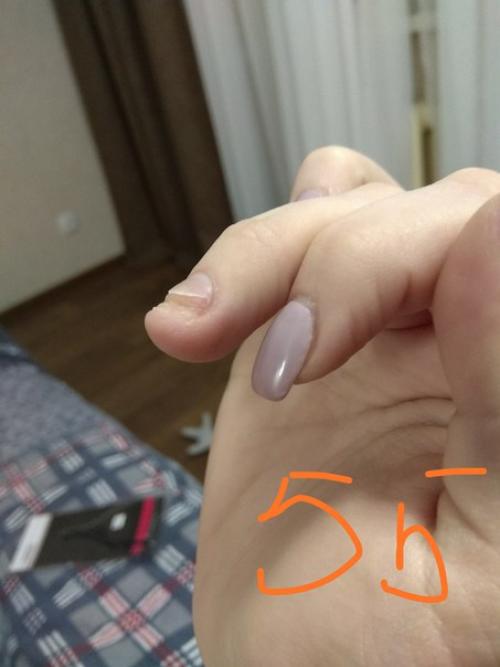 Всём привет, я выкладывали пост с просьбой о помощи 13 го января. 06 Всём привет, я выкладывали пост с просьбой о помощи 13 го января. 06