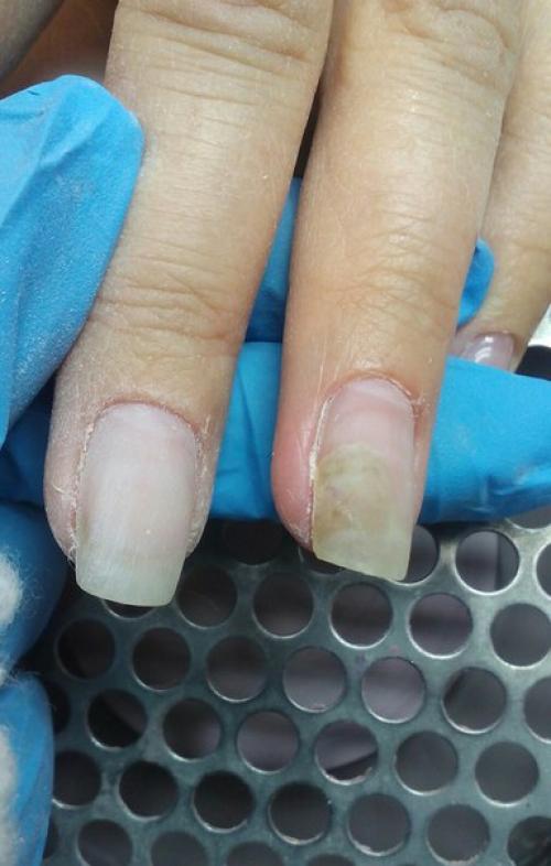 Девочки подскажите что это может быть! 01