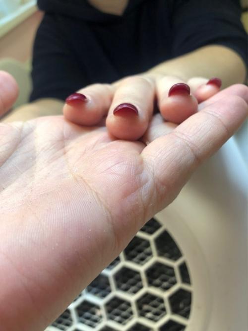 Аллергия на гель - лак: причины, симптомы, лечение. 01 Аллергия на гель - лак: причины, симптомы, лечение. 01