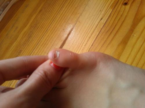 Девочки!  Помогите!  Что такое с ноготком? 01