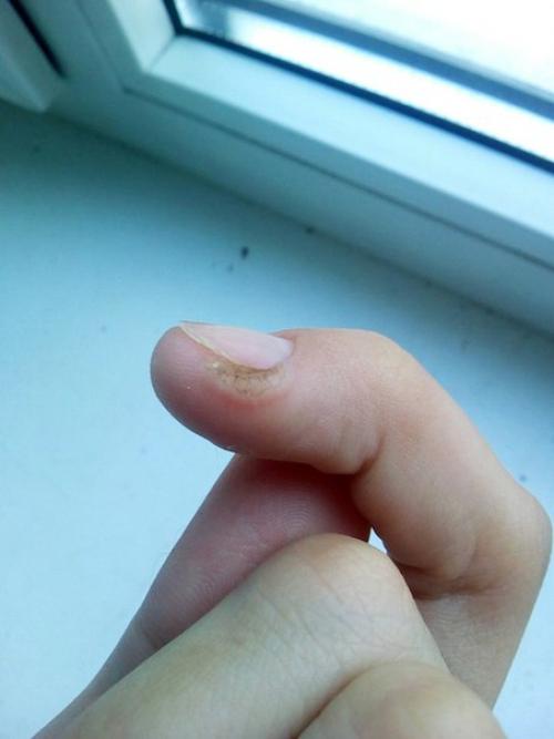 Пару месяцев назад сходила к Мастеру на маникюр, она мне просто половину боковых валиков оторвала. 01