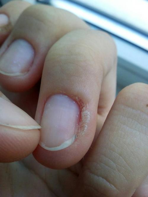 Пару месяцев назад сходила к Мастеру на маникюр, она мне просто половину боковых валиков оторвала. 02