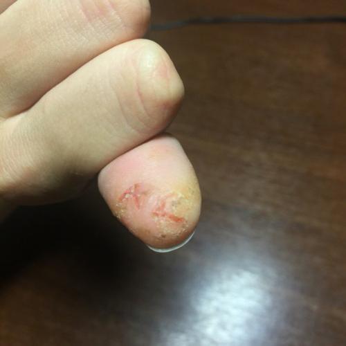 Девочки, выручайте!  Невозможно дотрагиваться до чего-либо. 02